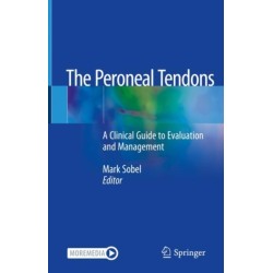 The Peroneal Tendons: A Clinical Guide to Evaluation and Management