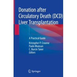 Donation after Circulatory Death (DCD) Liver Transplantation: A Practical Guide