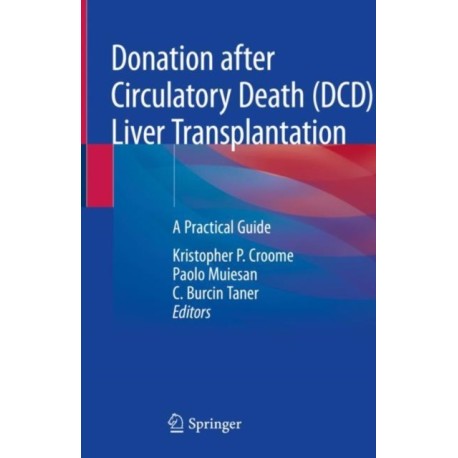 Donation after Circulatory Death (DCD) Liver Transplantation: A Practical Guide