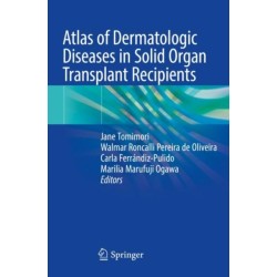 Atlas of Dermatologic Diseases in Solid Organ Transplant Recipients