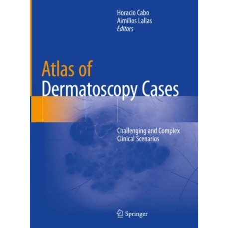 Atlas of Dermatoscopy Cases: Challenging and Complex Clinical Scenarios
