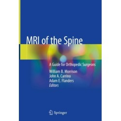 MRI of the Spine: A Guide for Orthopedic Surgeons