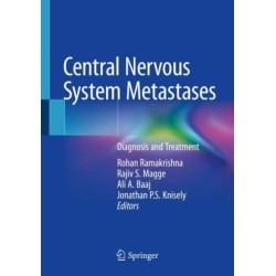 Central Nervous System Metastases: Diagnosis and Treatment