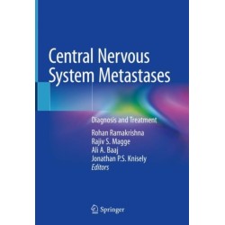 Central Nervous System Metastases: Diagnosis and Treatment