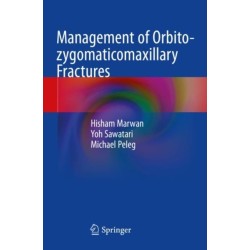 Management of Orbito-zygomaticomaxillary Fractures