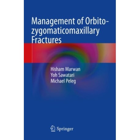 Management of Orbito-zygomaticomaxillary Fractures
