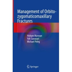 Management of Orbito-zygomaticomaxillary Fractures