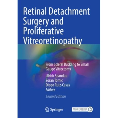 Retinal Detachment Surgery and Proliferative Vitreoretinopathy: From Scleral Buckling to Small Gauge Vitrectomy