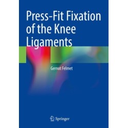 Press-Fit Fixation of the Knee Ligaments