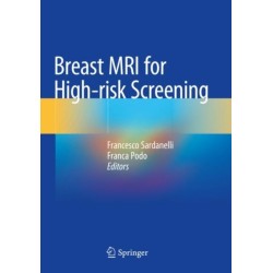 Breast MRI for High-risk Screening