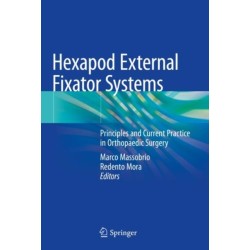 Hexapod External Fixator Systems: Principles and Current Practice in Orthopaedic Surgery