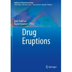Drug Eruptions