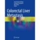 Colorectal Liver Metastasis