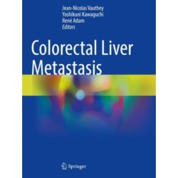 Colorectal Liver Metastasis