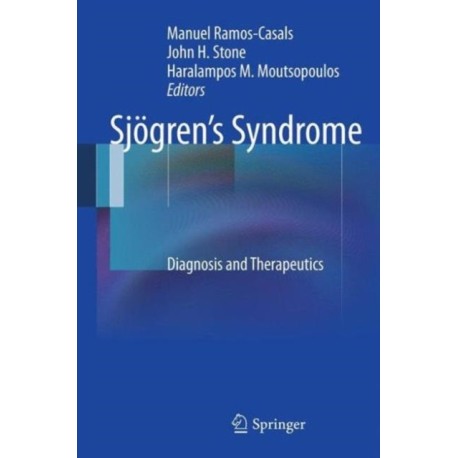 Sjogren’s Syndrome: Diagnosis and Therapeutics