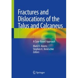 Fractures and Dislocations of the Talus and Calcaneus: A Case-Based Approach