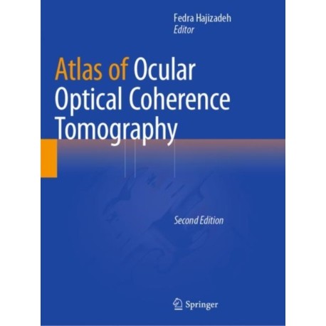 Atlas of Ocular Optical Coherence Tomography