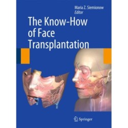 The Know-How of Face Transplantation