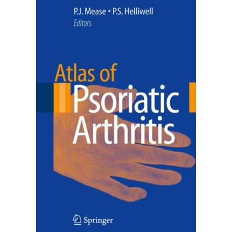 Atlas of Psoriatic Arthritis