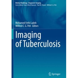 Imaging of Tuberculosis