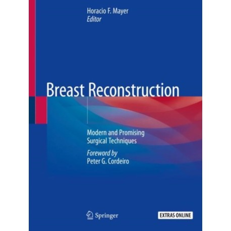 Breast Reconstruction: Modern and Promising Surgical Techniques