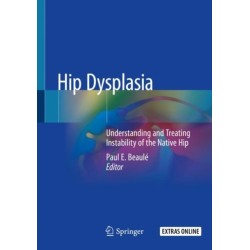 Hip Dysplasia: Understanding and Treating Instability of the Native Hip