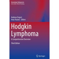 Hodgkin Lymphoma: A Comprehensive Overview
