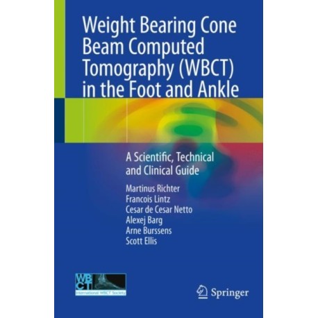 Weight Bearing Cone Beam Computed Tomography (WBCT) in the Foot and Ankle: A Scientific, Technical and Clinical Guide