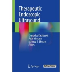 Therapeutic Endoscopic Ultrasound