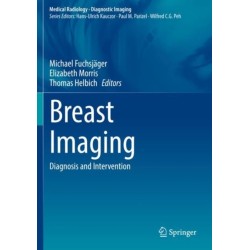 Breast Imaging: Diagnosis and Intervention