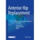 Anterior Hip Replacement: From Origin to Current Advanced Techniques