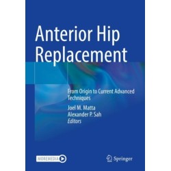 Anterior Hip Replacement: From Origin to Current Advanced Techniques