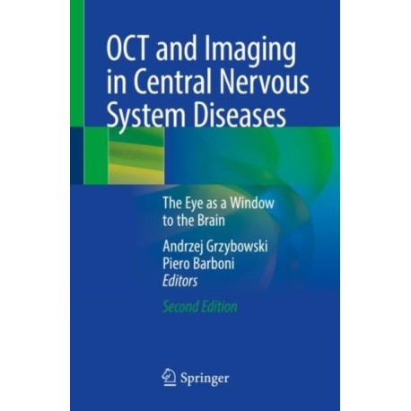 OCT and Imaging in Central Nervous System Diseases: The Eye as a Window to the Brain