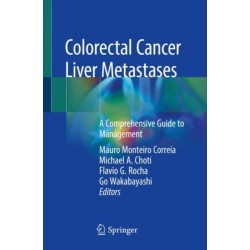 Colorectal Cancer Liver Metastases: A Comprehensive Guide to Management