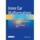 Inner Ear Malformations: Classification, Evaluation and Treatment