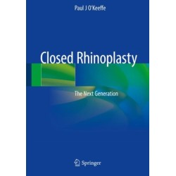 Closed Rhinoplasty: The Next Generation