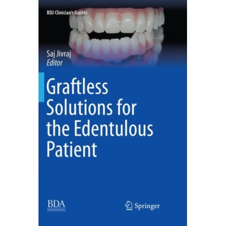 Graftless Solutions for the Edentulous Patient