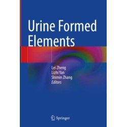 Urine Formed Elements