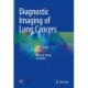 Diagnostic Imaging of Lung Cancers