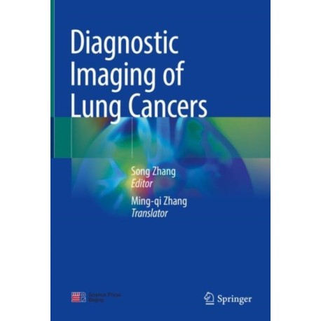 Diagnostic Imaging of Lung Cancers