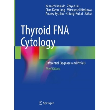 Thyroid FNA Cytology: Differential Diagnoses and Pitfalls