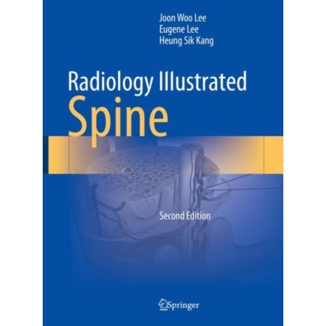Radiology Illustrated: Spine