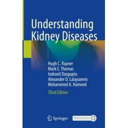 Understanding Kidney Diseases