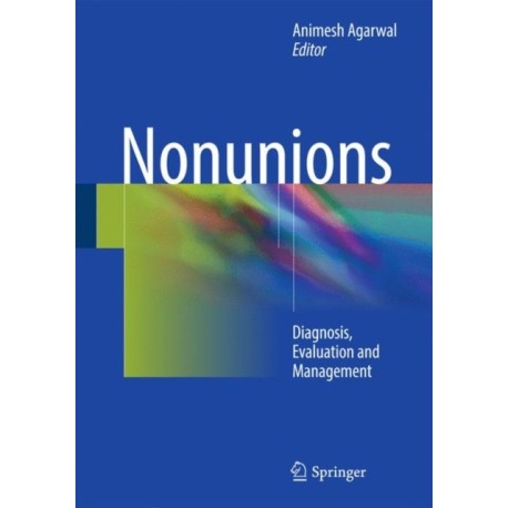 Nonunions: Diagnosis, Evaluation and Management