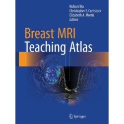 Breast MRI Teaching Atlas