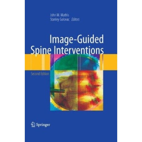 Image-Guided Spine Interventions