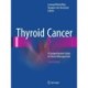 Thyroid Cancer: A Comprehensive Guide to Clinical Management