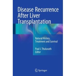 Disease Recurrence After Liver Transplantation: Natural History, Treatment and Survival
