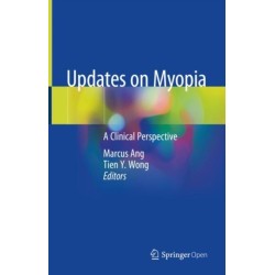 Updates on Myopia: A Clinical Perspective