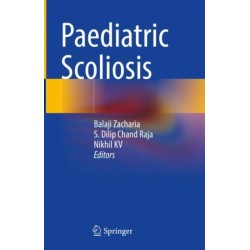 Paediatric Scoliosis